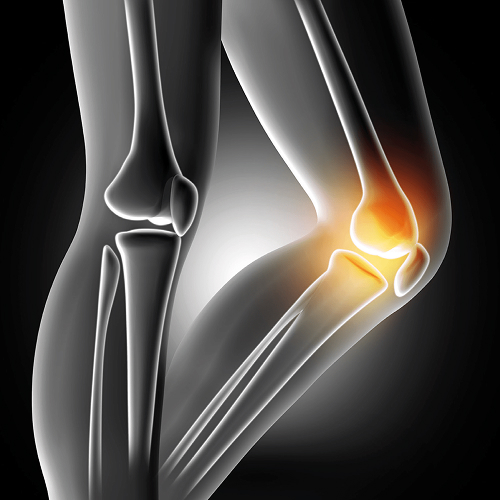 So-Visc_1.1 1 So-Visc_1.1 1