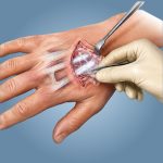 OrthoWrap®01